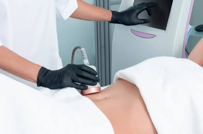 Effective Body Contouring with Indiba Treatment
